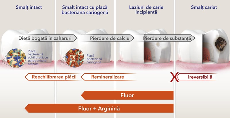 Managementul cariei dentare Managementul cariei dentare