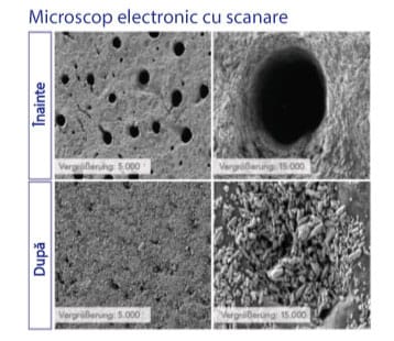 Microscop electronic cu scanare